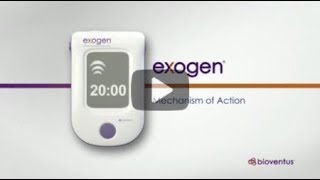 EXOGEN Mechanism of Action ous [upl. by Almire]