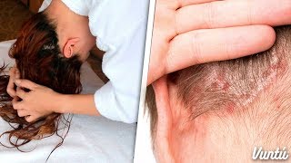 7 enfermedades que te causa dormir con el cabello mojado [upl. by Costanzia467]