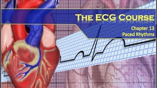 The ECG Course  Paced Rhythms [upl. by Ariahaj366]