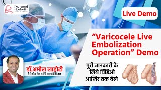 Understanding Varicocele Treatment  Angiography amp Wire Placement in Embolization  Dr Amol Lahoti [upl. by Dey522]