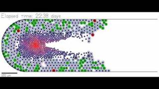 Ductal carcinoma in situ DCIS simulation [upl. by Nesyrb]