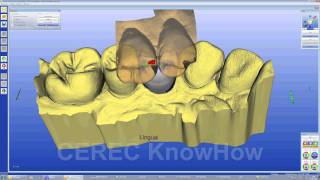 CEREC® Crown Multilayer  Crown  Software [upl. by Walkling504]