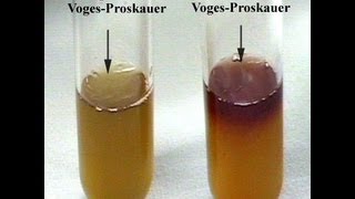 VogesProskauer Test  Amrita University [upl. by Octavius222]