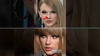 Did Taylor Swift have Plastic Surgery [upl. by Andrea]