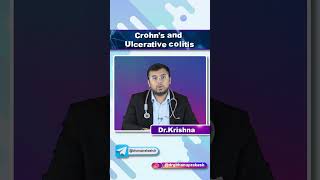 Crohns Disease vs Ulcerative Colitis  Quick Bites Internal Medicine Gastroenterology [upl. by Odnalra275]