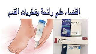 التخلص من رائحة القدم الكريهة والفطريات [upl. by Etterb275]