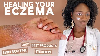 How to Treat ECZEMAAtopic Dermatitis Black Dark Skin Dry Flaky Skincare Routine Hyperpigmentation [upl. by Hannavahs]