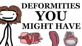 Deformities That You Might Have [upl. by Ivers460]