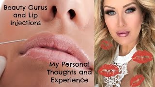 MY LIP INJECTION EXPERIENCE  Why So Many Beauty Youtubers Get Them [upl. by Ocirrej]