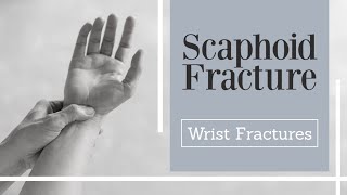 Scaphoid Fractures  carpal bone fracture [upl. by Susie]