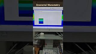 Biofeedback therapy  An important tool to manage constipation [upl. by Fin]