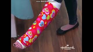 Clip 557 Its broken cast crutches non weight bearing Close up toes and cast [upl. by Atterol575]