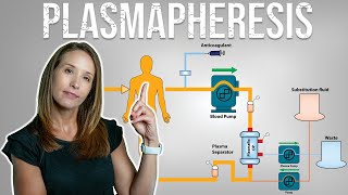 Unlocking the Secrets of Plasmapheresis Treatment for Long Covid [upl. by Ibbed]