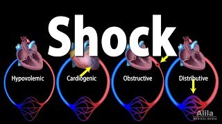 Shock Pathology of Different Types Animation [upl. by Rehotsirk]