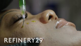 I Tried a Chemical Peel for Glass Skin BioRePeel  Macro Beauty  Refinery29 [upl. by Roht]