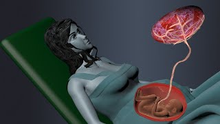 Fertilization Development of Placenta Labor and Delivery 3D Animation [upl. by Susann]