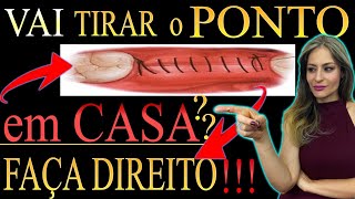 Como remover os Pontos Sutura da extração de dente SISO EM CASA CUIDADO [upl. by Ehman]