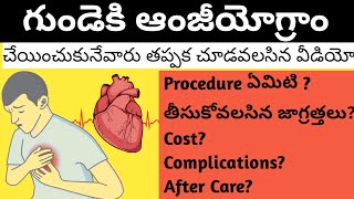 Coronary Angiogram Heart గుండె అంజీయోగ్రాం చేయించుకునేవారు తప్పక చూడవలసిన వీడియో [upl. by Maeve441]