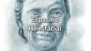 Espasmo Hemifacial [upl. by Jessen614]