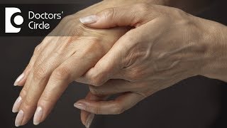 Role of homeopathy in treating Rheumatoid Arthritis  Dr Surekha Tiwari [upl. by Yrallam]