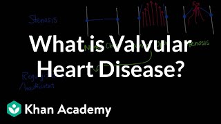 What is valvular heart disease  Circulatory System and Disease  NCLEXRN  Khan Academy [upl. by Ibmab]