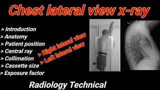 Chest Lateral view Xray  Right amp Left lateral projection  Chest radiography  By BL Kumawat [upl. by Ametaf]