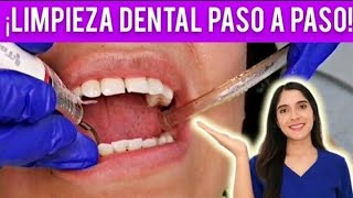 ¿CÓMO SE HACE UNA LIMPIEZA DENTAL DE CONSULTORIO  TE MUESTRO CADA PASO 🦷✅ [upl. by Burrows]