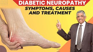 What Causes Diabetic Neuropathy  Peripheral Neuropathy  Dr V Mohan [upl. by Hsital]