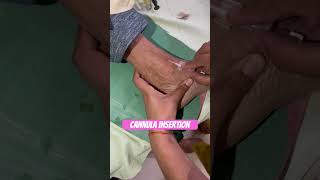 Cannula insertion in a female patient into the foot nurses mbbs neet bscnursing neetstudents [upl. by Bradshaw]