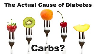 The ACTUAL Cause of Type 2 Diabetes Carbs [upl. by Annaillil236]