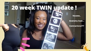 20 weeks twin pregnancy symptoms anatomy scan  didi Twins [upl. by Aya]