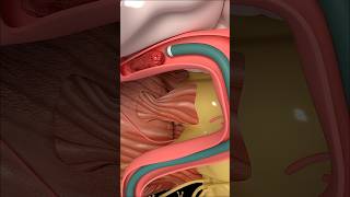 Mechanical Thrombectomy in stroke medicine anatomy  short viral [upl. by Josy641]