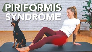 Buttock pain Test this exercise immediately Piriformis syndrome [upl. by Esele]