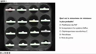 Lecture interprétative de l’antibiogramme de Pseudomonas aeruginosa [upl. by Iborian]