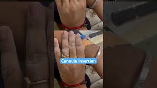 Cannula insertion of adolescent girl nurses cannula youtubeshorts ytshortsdoctorneetmbbs gnm [upl. by Alakam770]