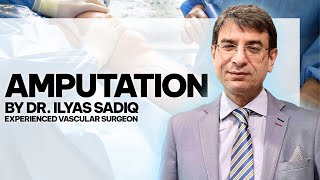 What Is Amputation amp How Its Done Explained By Dr Ilyas Sadiq Vascular Surgeon [upl. by Yeoj]