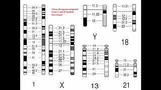 Cytogenetics II Chromosome Analysis amp Karyotypes [upl. by Alket]