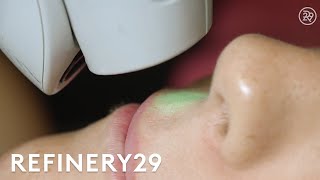 I Got Laser Hair Removal For The First Time  Macro Beauty  Refinery29 [upl. by Vig]