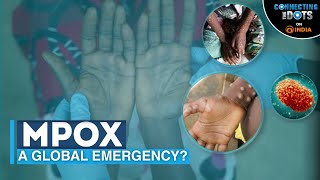 Mpox Outbreak How Deadly Is Monkeypox Virus  Connecting The Dots [upl. by Airdnat]