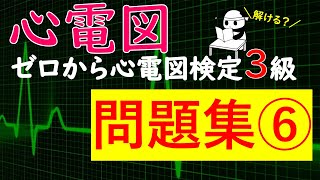 問題集⑥ ゼロから心電図検定4級3級 [upl. by Eahc]