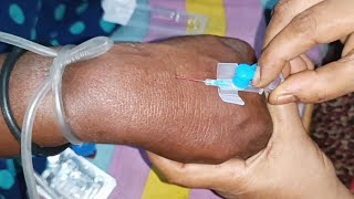 iv Cannulation Cannula Push 24 Ep 31 By injection Point [upl. by Sari43]