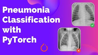 Detecting Pneumonia from Chest XRay images with PyTorch [upl. by Teage]