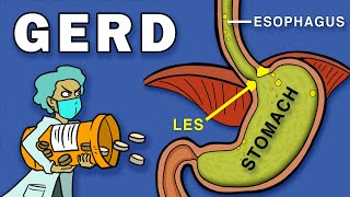 Hiatal Hernia Relief Effective Manual Therapy Techniques amp Assessment  ErikDaltoncom [upl. by Elum305]