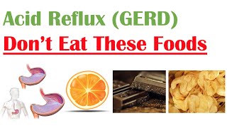 Worst Foods to Eat with Acid Reflux GERD Gastroesophageal Reflux Disease  How to Reduce Symptoms [upl. by Roehm]