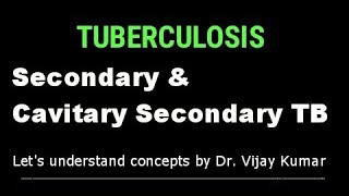 Secondary Pulmonary TB  Pulmonary TB  Secondary TB  Tuberculous Infection  Pathology Lectures [upl. by Alleinad]