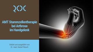 AMT Stammzellentherapie bei Arthrose im Handgelenk  ROC Aschheim [upl. by Annaeel761]