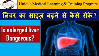 Non alcoholic liver diseases  Can enlarged Liver be reversed or cured [upl. by Enitsenre]