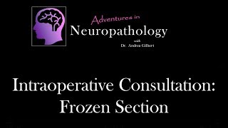 Intraoperative Consultation Frozen Section  Adventures in Neuropathology [upl. by Sivrep]