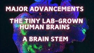 Giving the labgrown brains a brainstem [upl. by Inaluiak589]