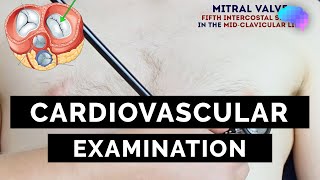 Cardiovascular Examination  OSCE Guide  UKMLA  CPSA [upl. by Kciv697]